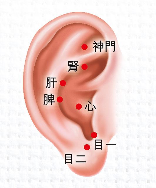 耳诊耳疗：一学就会的耳穴疗法